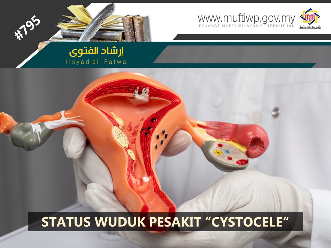 APAKAH_STATUS_WUDUK_PESAKIT_CYSTOCELE.jpg