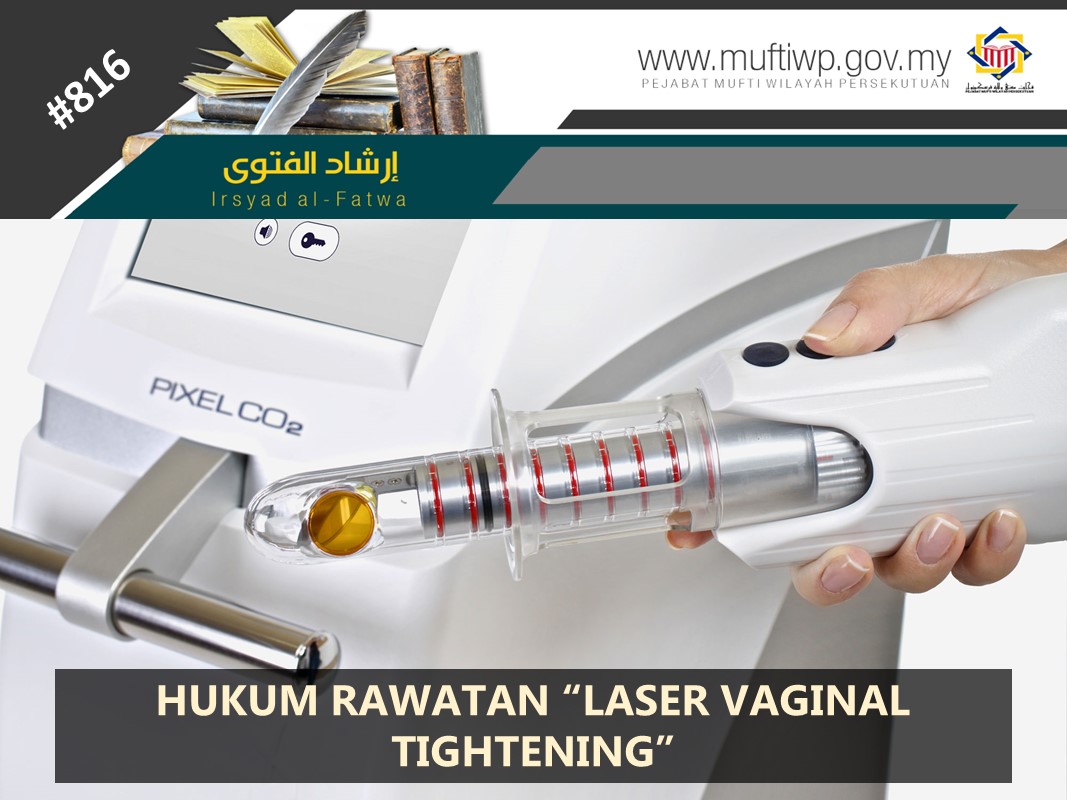 HUKUM_RAWATAN_LASER_VAGINAL_TIGHTENING.jpg